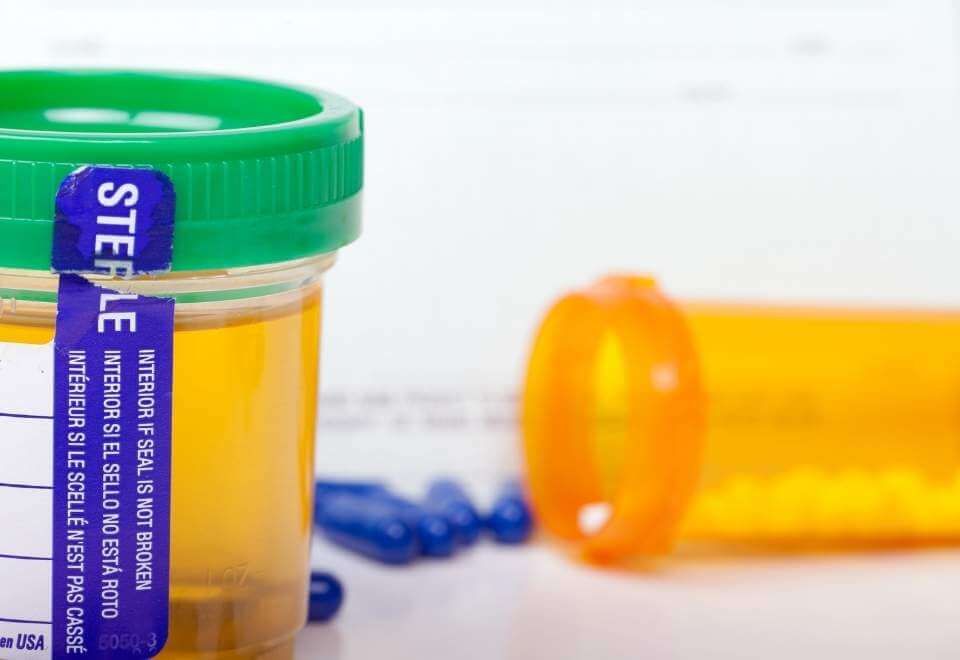ตรวจสาร CBD Two bottles of urine sample